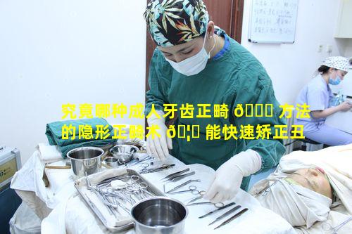 究竟哪种成人牙齿正畸 🐛 方法的隐形正畸术 🦈 能快速矫正丑牙